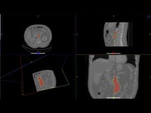 An image of AI-powered CT imaging technology for AiSentia